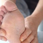Tips on the soles of the feet