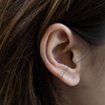 Why did the pimple appear on the earlobe?