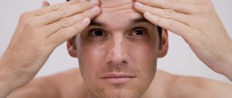 Why do men&#39;s eyebrows peel?