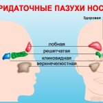 Paranasal sinuses