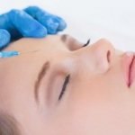 The procedure for injecting Botox into the forehead is simple and fast! NEOMED Clinic 