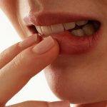 Рак губы: симптомы и лечение