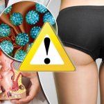 Risk of colon cancer if the anus is infected with HPV