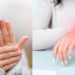 Симптомы артрита кистей рук
