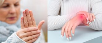 Symptoms of hand arthritis