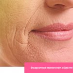 Age-related changes in the lip area